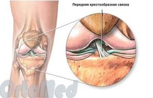 анатомия крестообразных связок колена