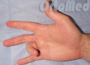 Щелкающий палец