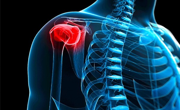 остеопороз плечевого сустава